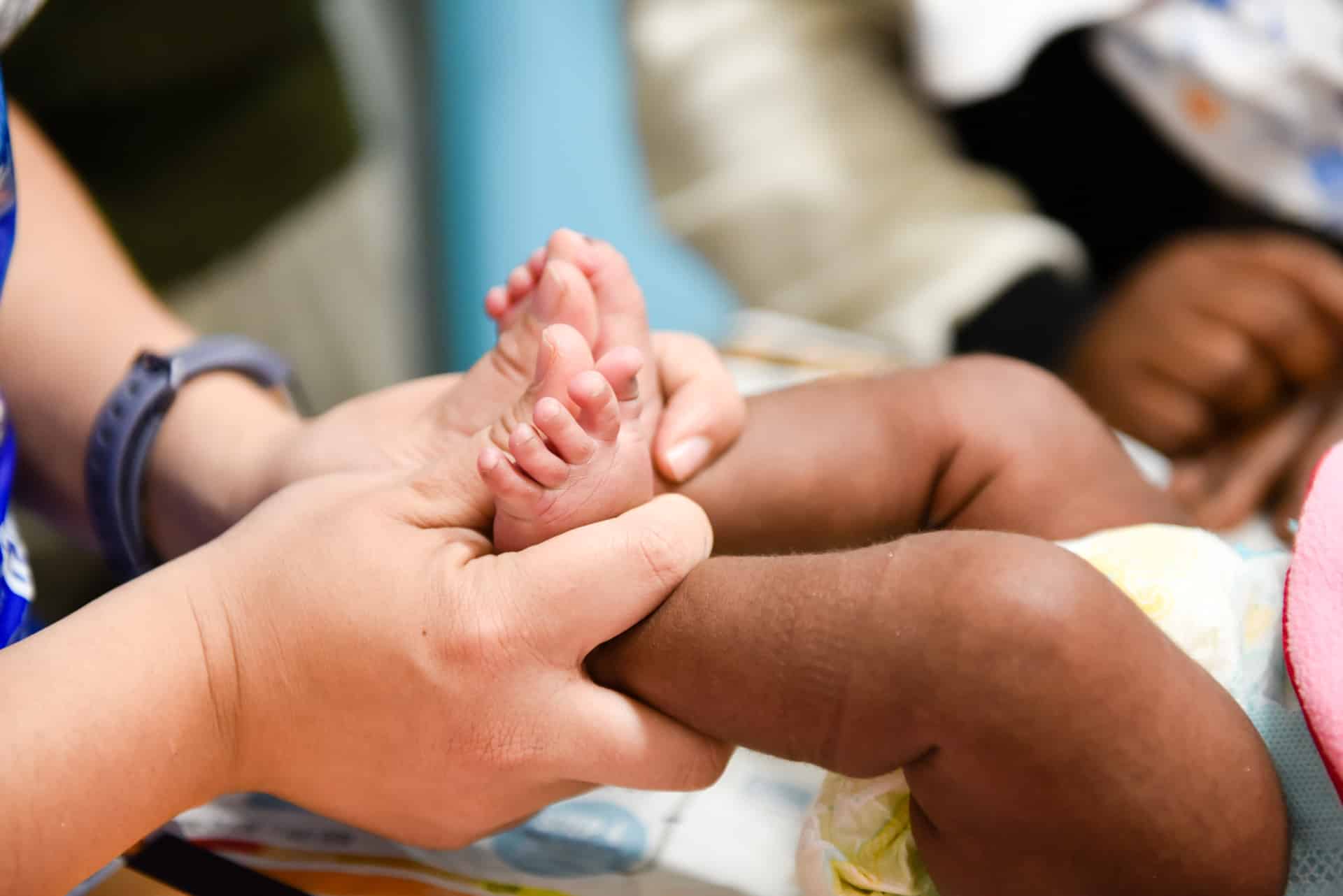 SABFSIA 2018 - Steps Clubfoot Care (19)